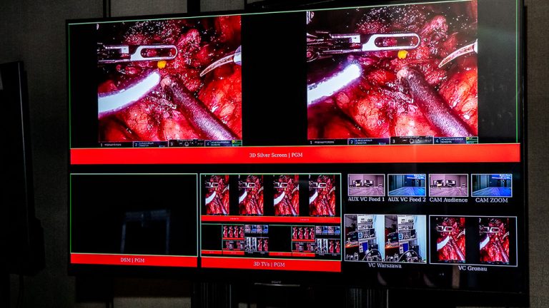 PCSS partnerem sesji Live Surgery podczas 1. Sympozjum Sekcji Urologii Robotowej PTU